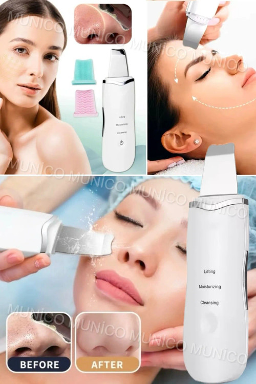 دستگاه اسپاتول صورت ۴ در ۱ – پاککننده ژرف و حذفکننده جوشهای سرسیاه