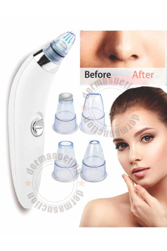 دستگاه وکیومی درماساکشن ۴۰ kPa – پاکسازی و حذف جوش سر سیاه