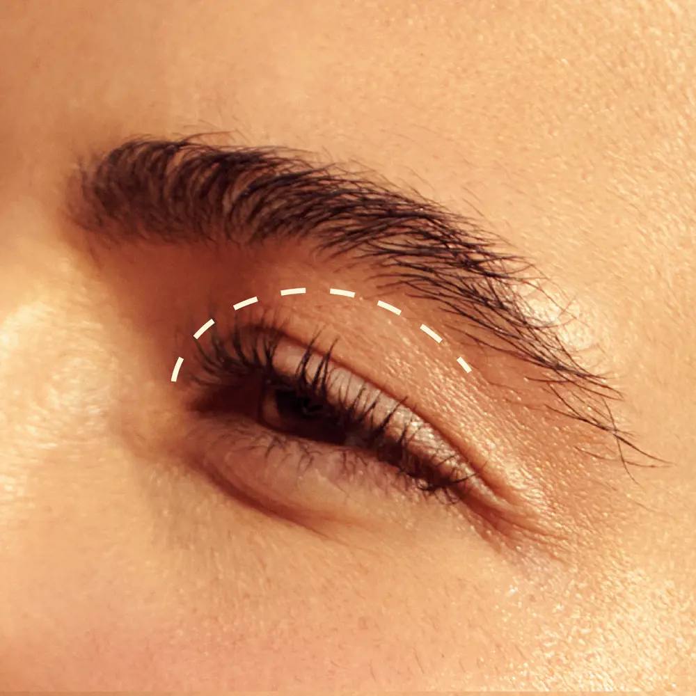 براش محوکننده